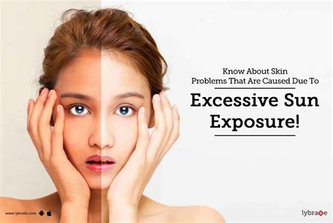 What Is The Impact Of Excessive Sun Exposure On Skin?